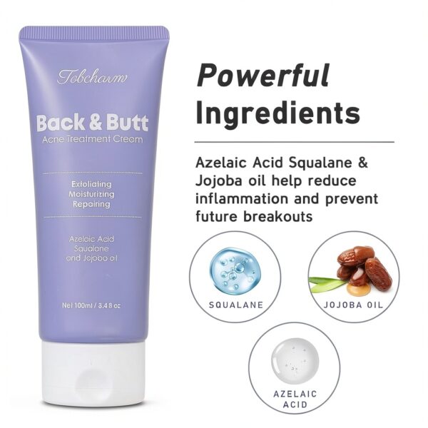 Tobcharm Akne Creme für den Rücken, Anti Pickel Creme am Gesäß, Behandlung von Akne am Körper mit Azelainsäure 100 ml, Acne Creme Behandlung von Pickel, Creme gegen Pickel, Rücken-Akne-Behandlung-1