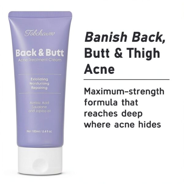 Tobcharm Akne Creme für den Rücken, Anti Pickel Creme am Gesäß, Behandlung von Akne am Körper mit Azelainsäure 100 ml, Acne Creme Behandlung von Pickel, Creme gegen Pickel, Rücken-Akne-Behandlung-3